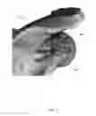 Fig. 02 - Glenosphere with hood for augmented fixation and related methods