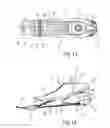Fig. 09 - PROSTHETIC FOOT