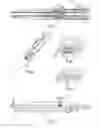 Fig. 03 - Controlled expansion stent graft delivery system