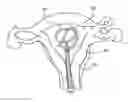 Fig. 01 - Intra uterine device