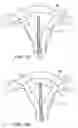 Fig. 02 - Intra uterine device