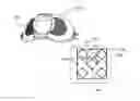 Fig. 01 - Patient interface comprising a gas washout vent