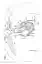 Fig. 02 - Malleable Cannula
