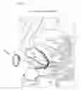 Fig. 09 - System and method for minimally invasive lead implantation for cavernosal nerve stimulation controlled and powered wirelessly from an external source