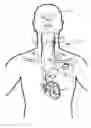 Fig. 01 - VAGUS NERVE STIMULATION AND SUBCUTANEOUS DEFIBRILLATION SYSTEM