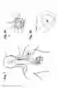 Fig. 02 - VAGUS NERVE STIMULATION AND SUBCUTANEOUS DEFIBRILLATION SYSTEM