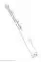 Fig. 01 - Baseball/softball bat with shock dissipation characteristics and method of manufacturing same