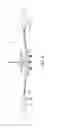 Fig. 05 - Dual mode aircraft light assembly