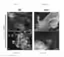 Fig. 22 - Method for differentiation into retinal ganglion cells from stem cells