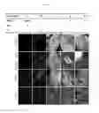 Fig. 23 - Method for differentiation into retinal ganglion cells from stem cells