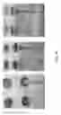 Fig. 27 - Sieve valves, microfluidic circuits, microfluidic devices, kits, and methods for isolating an analyte