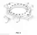 Fig. 03 - INTEGRATED CASING DRIVE