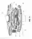 Fig. 12 - INTEGRATED CASING DRIVE