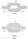 Fig. 07 - Serpentine flow channels for flowing fluids over chip sensors