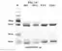 Fig. 04 - Method of measuring cholesterol levels by using immunogenic method