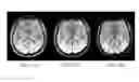 Fig. 16 - System and method for magnetic resonance imaging