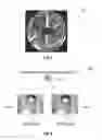 Fig. 09 - Lens distortion correction using a neurosynaptic circuit