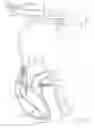 Fig. 02 - Implantable lead assembly