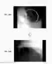 Fig. 19 - Endoscope