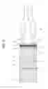 Fig. 22 - Endoscope