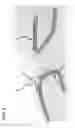 Fig. 07 - PORTABLE EYE TRACKING DEVICE