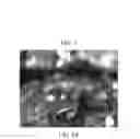 Fig. 03 - Image processing method and apparatus