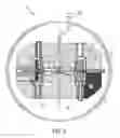 Fig. 08 - Treatment planning