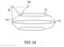 Fig. 32 - Treatment planning