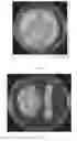 Fig. 02 - Compositions and methods comprising endophytic bacterium for application to grasses to increase plant growth, suppress soil borne fungal diseases, and reduce vigor of weedy competitors