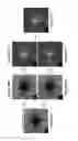 Fig. 08 - Automated quantification of nonperfusion in the retina using optical coherence tomography angiography