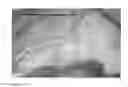 Fig. 09 - Method for evaluating blush in myocardial tissue