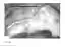Fig. 10 - Method for evaluating blush in myocardial tissue
