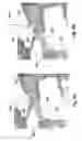 Fig. 06 - Stapedius Muscle Reflex Recording Electrode with a Sacrificial Part