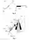 Fig. 09 - Stapedius Muscle Reflex Recording Electrode with a Sacrificial Part