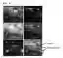 Fig. 07 - Apparatus and method for detecting NIR fluorescence at sentinel lymph node