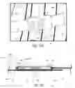 Fig. 35 - PROSTHETIC SOCKETS WITH SENSORS