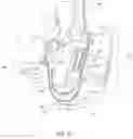 Fig. 43 - PROSTHETIC SOCKETS WITH SENSORS