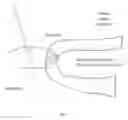 Fig. 02 - Tissue-orientation-based simulation of deep brain stimulation