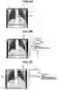 Fig. 06 - X-ray CT apparatus