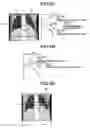 Fig. 08 - X-ray CT apparatus