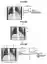 Fig. 09 - X-ray CT apparatus