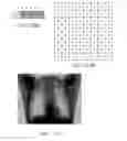 Fig. 11 - RADIATION DETECTOR AND RADIOGRAPHIC IMAGING DEVICE