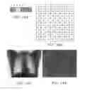 Fig. 12 - RADIATION DETECTOR AND RADIOGRAPHIC IMAGING DEVICE