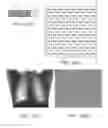 Fig. 14 - RADIATION DETECTOR AND RADIOGRAPHIC IMAGING DEVICE