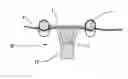 Fig. 01 - FISTULA PLUG
