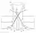 Fig. 01 - Laparoscopic port site closure tool