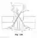 Fig. 09 - Laparoscopic port site closure tool