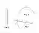 Fig. 02 - Suture locking loops and method of use