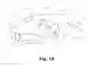 Fig. 07 - Suture locking loops and method of use