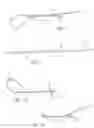 Fig. 02 - Adjustable knotless loops